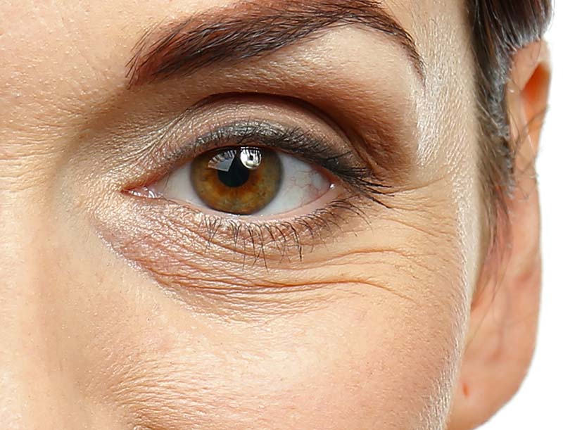 Anti-Wrinkle Treatment