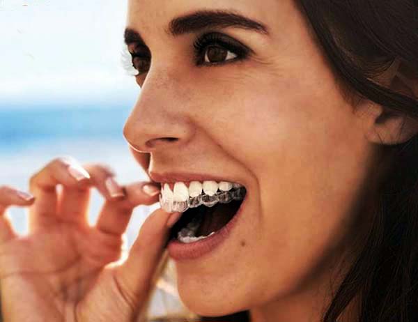 Lady using invisalign braces