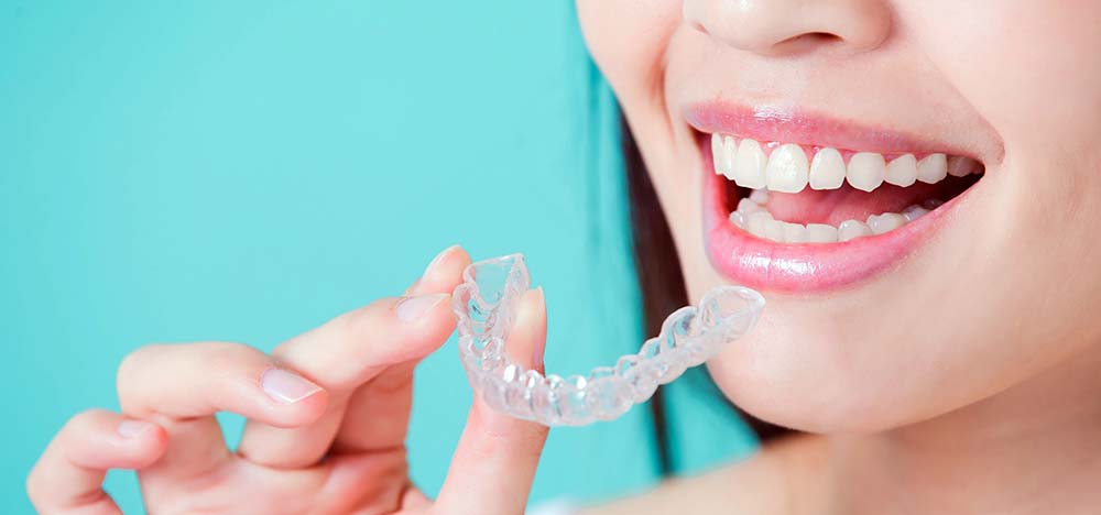 Invisalign-Invisible braces for your teeth