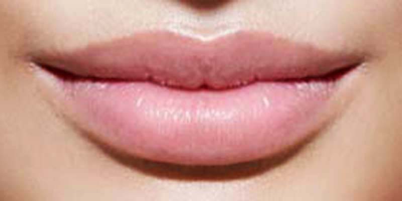 Lip enhancement pictures